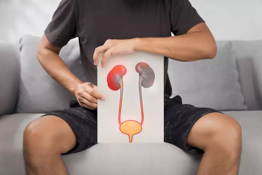 La Urostomia